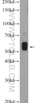 Desmin Antibody in Western Blot (WB)