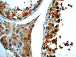TMF1 Antibody in Immunohistochemistry (Paraffin) (IHC (P))