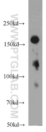 TMF1 Antibody in Western Blot (WB)