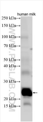 SOSTDC1 Antibody in Western Blot (WB)