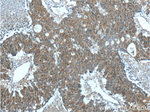 FERMT1 Antibody in Immunohistochemistry (Paraffin) (IHC (P))
