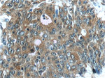FERMT1 Antibody in Immunohistochemistry (Paraffin) (IHC (P))