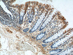 FERMT1 Antibody in Immunohistochemistry (Paraffin) (IHC (P))