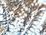 FERMT1 Antibody in Immunohistochemistry (Paraffin) (IHC (P))