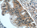 FERMT1 Antibody in Immunohistochemistry (Paraffin) (IHC (P))