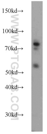 FERMT1 Antibody in Western Blot (WB)