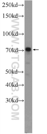 FERMT1 Antibody in Western Blot (WB)