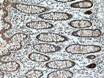 FERMT1 Antibody in Immunohistochemistry (Paraffin) (IHC (P))