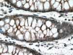 FERMT1 Antibody in Immunohistochemistry (Paraffin) (IHC (P))