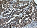 FERMT1 Antibody in Immunohistochemistry (Paraffin) (IHC (P))
