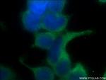 FERMT1 Antibody in Immunocytochemistry (ICC/IF)