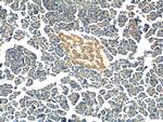 FERMT1 Antibody in Immunohistochemistry (Paraffin) (IHC (P))