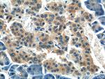FERMT1 Antibody in Immunohistochemistry (Paraffin) (IHC (P))
