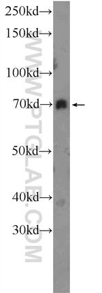 FERMT1 Antibody in Western Blot (WB)