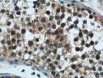Rabenosyn 5 Antibody in Immunohistochemistry (Paraffin) (IHC (P))