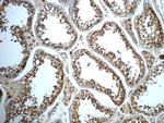 ALDH1B1 Antibody in Immunohistochemistry (Paraffin) (IHC (P))