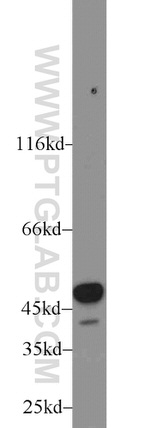 ALDH1B1 Antibody in Western Blot (WB)