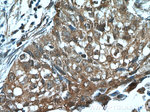 Cytokeratin 14 Antibody in Immunohistochemistry (Paraffin) (IHC (P))
