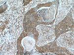 Cytokeratin 14 Antibody in Immunohistochemistry (Paraffin) (IHC (P))