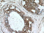 Cytokeratin 14 Antibody in Immunohistochemistry (Paraffin) (IHC (P))