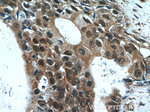 Cytokeratin 14 Antibody in Immunohistochemistry (Paraffin) (IHC (P))