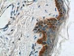 Cytokeratin 14 Antibody in Immunohistochemistry (Paraffin) (IHC (P))