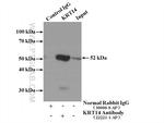 Cytokeratin 14 Antibody in Immunoprecipitation (IP)
