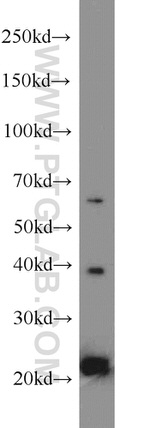 MPO Antibody in Western Blot (WB)