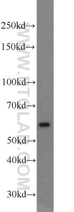 MPO Antibody in Western Blot (WB)