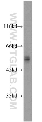 FOXP3 Antibody in Western Blot (WB)