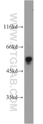 FOXP3 Antibody in Western Blot (WB)