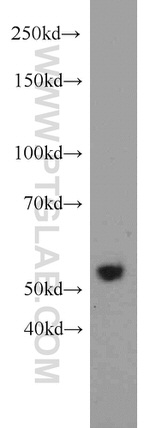 FOXP3 Antibody in Western Blot (WB)