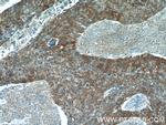Cytokeratin 17 Antibody in Immunohistochemistry (Paraffin) (IHC (P))