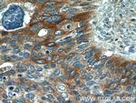 Cytokeratin 17 Antibody in Immunohistochemistry (Paraffin) (IHC (P))