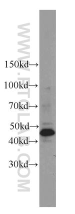 Cytokeratin 17 Antibody in Western Blot (WB)