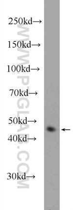 Cytokeratin 17 Antibody in Western Blot (WB)