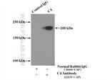 C4 alpha chain/C4b/C4d Antibody in Immunoprecipitation (IP)