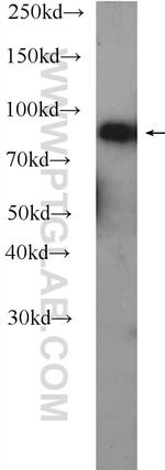 C4 alpha chain/C4b/C4d Antibody in Western Blot (WB)