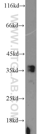 ADAM28 Antibody in Western Blot (WB)