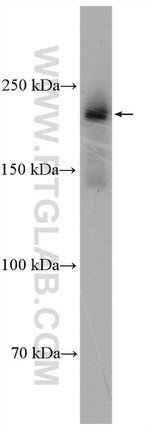 REST Antibody in Western Blot (WB)