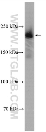 REST Antibody in Western Blot (WB)