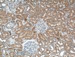 SPOCD1 Antibody in Immunohistochemistry (Paraffin) (IHC (P))