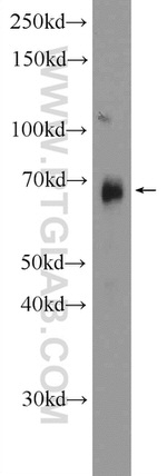 SPOCD1 Antibody in Western Blot (WB)
