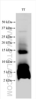 CALCA/CGRP Antibody in Western Blot (WB)