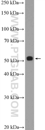 STK4/MST1 Antibody in Western Blot (WB)