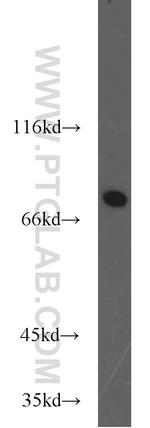 ADARB1 Antibody in Western Blot (WB)