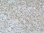 FAM98B Antibody in Immunohistochemistry (Paraffin) (IHC (P))