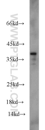 FAM98B Antibody in Western Blot (WB)