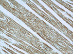 TNNI1 Antibody in Immunohistochemistry (Paraffin) (IHC (P))