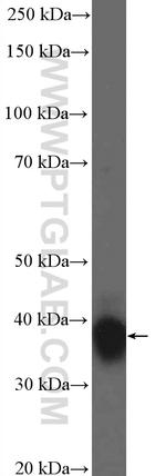 HOXB4 Antibody in Western Blot (WB)